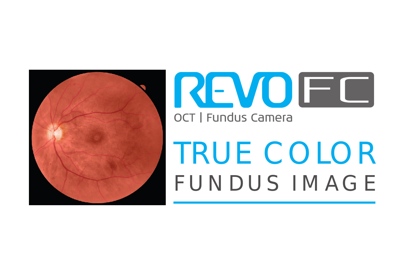 Eyetec_Optopol_REVO FC_48000016_012.jpg