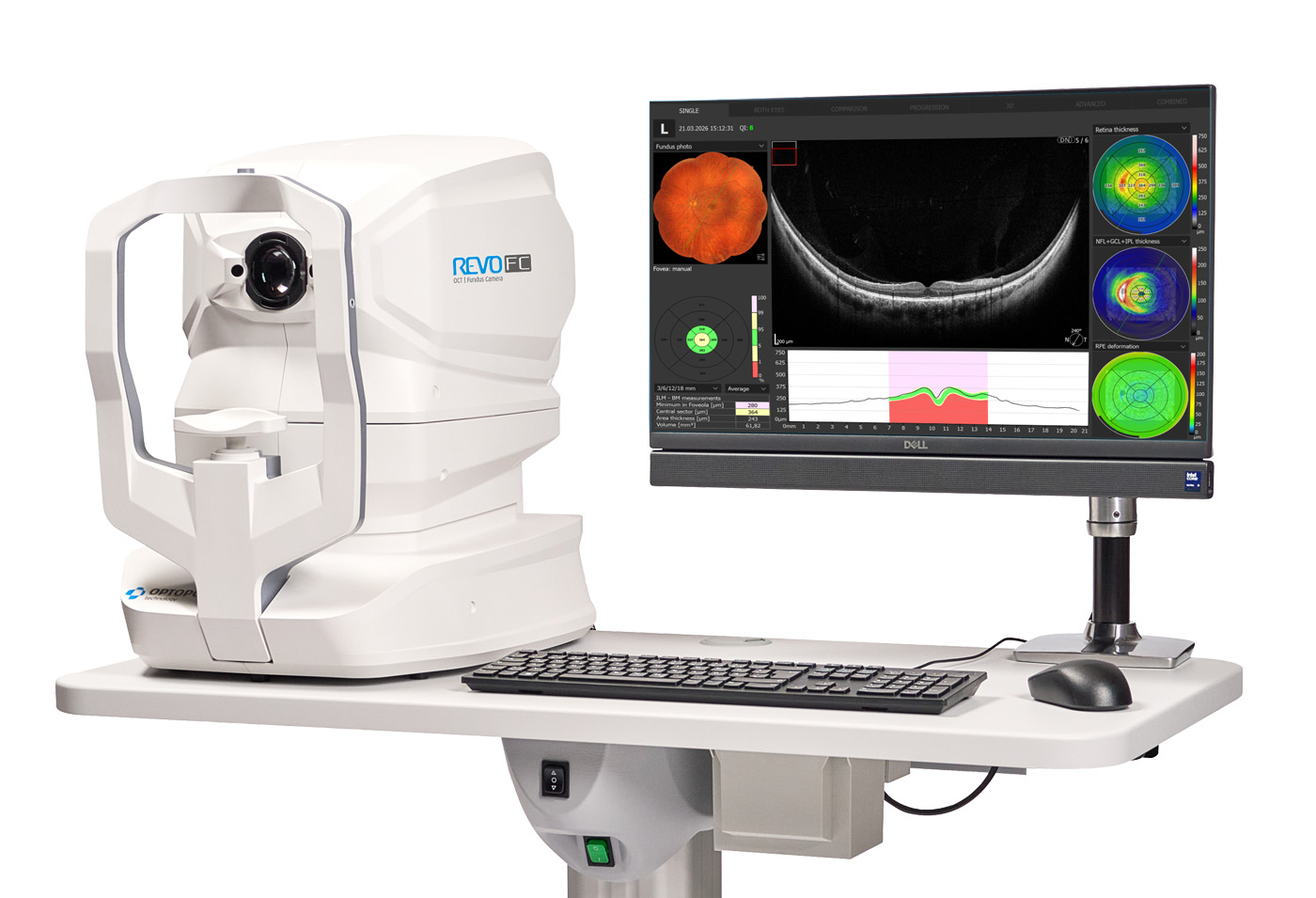 Eyetec_Optopol_REVO FC_48000016_001_1.jpg