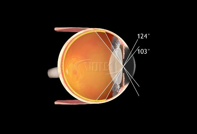 Eyetec_Volk_Digital Wide Field_45310006M_Parameter_003.jpg