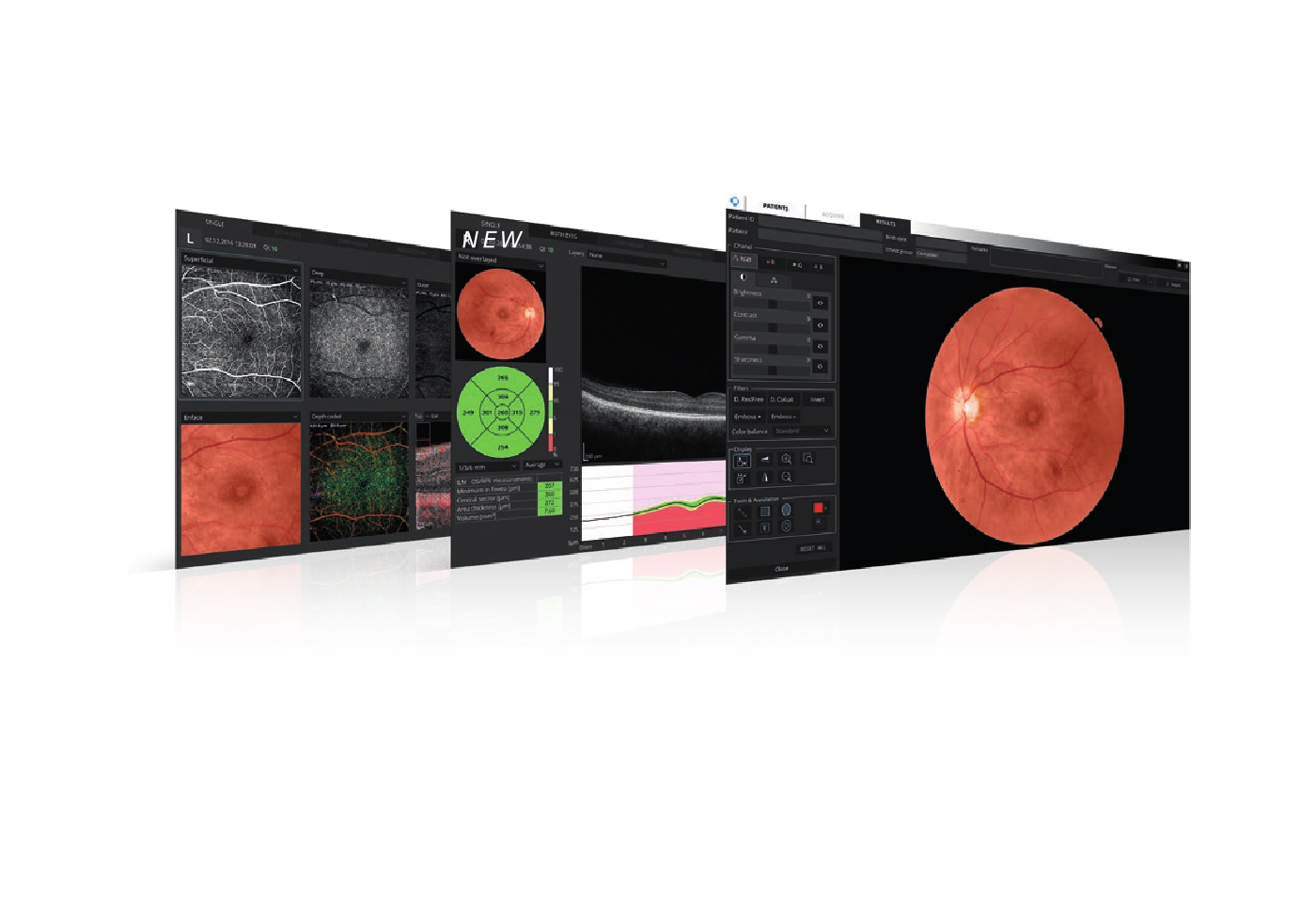 Eyetec_Optopol_REVO FC_48000016_014.jpg