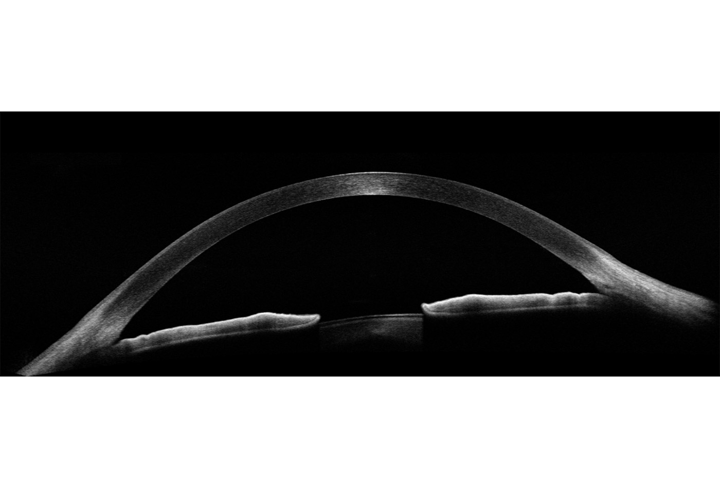 Eyetec_Optopol_REVO 80_48000020_013.jpg