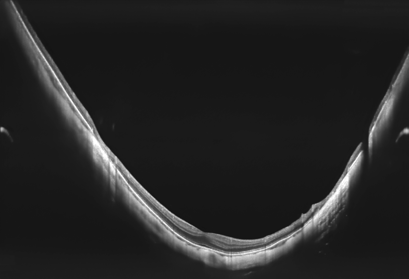 Eyetec_Optopol_REVO FC_48000016_015.png