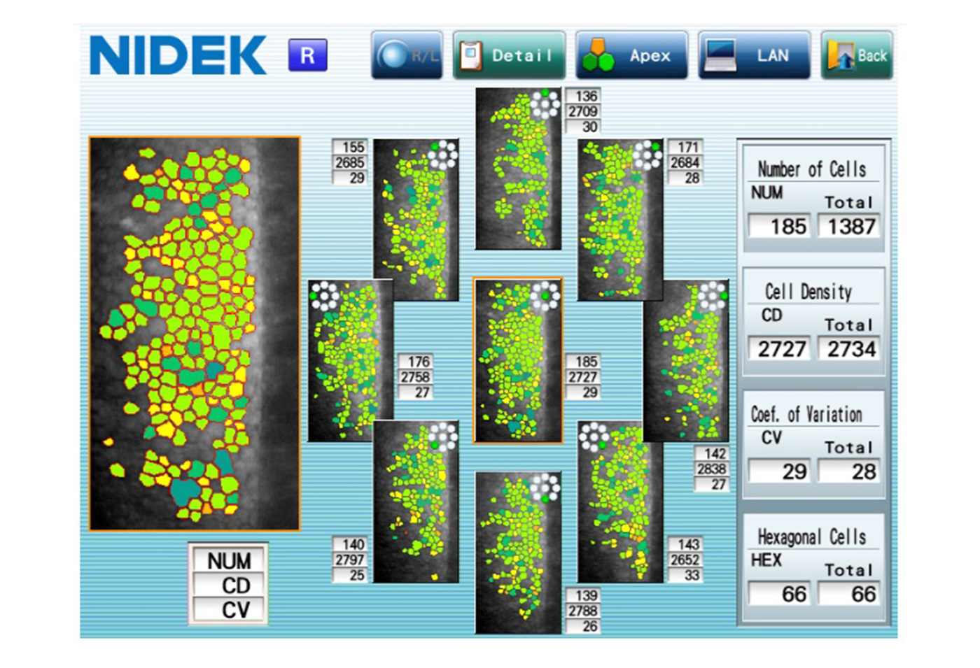 Eyetec_Nidek_CEM-530_49000004_005.jpg