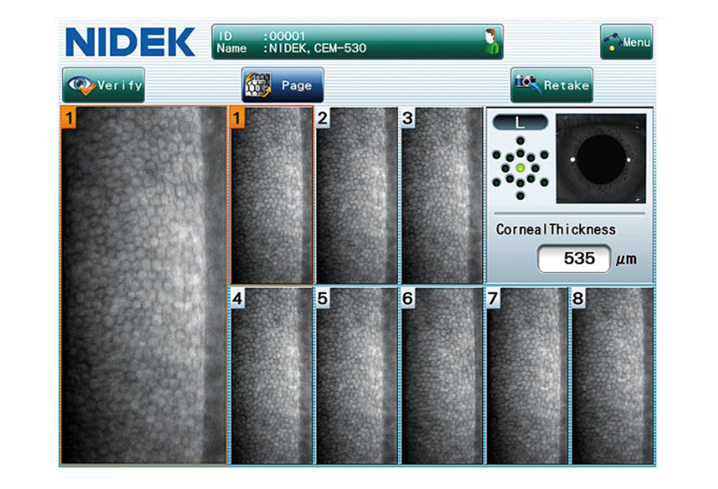 Eyetec_Nidek_CEM-530_49000004_004.jpg