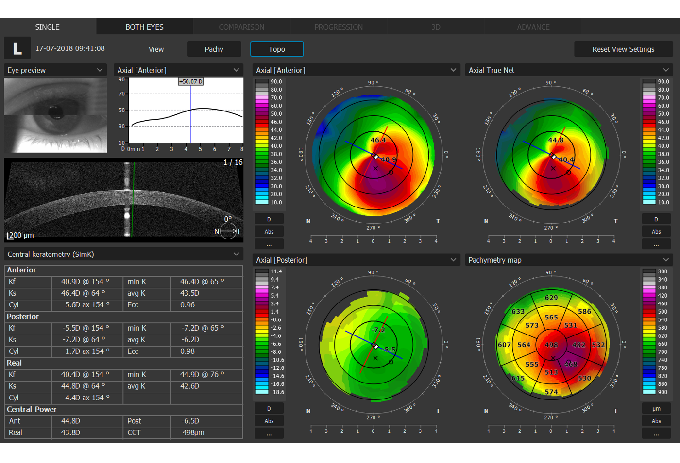 Copernicus REVO Topographie-Modul