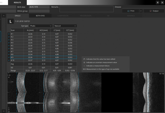 Copernicus REVO Biometrie & IOL