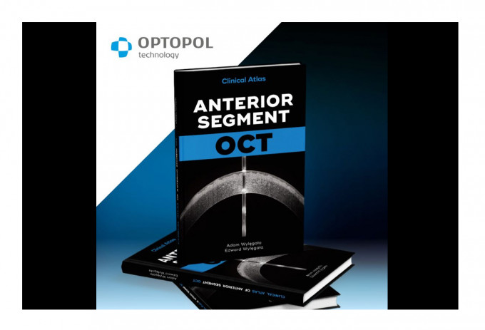 Clinical Atlas Anterior Segment OCT