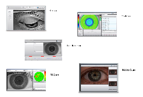 Oculus Keratograph 5M