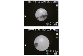 Nidek Autorefrakto-/ Keratometer ARK-1 / 1s