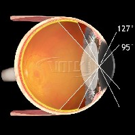 Volk indirektes vitreo Kontaktglas Dyna View 156 schwarz / mit Gravur