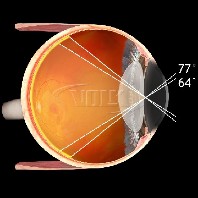 Volk ind. vitreo Kontaktglas Super Macula