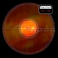 Volk Einweg Ophthalmoskopierlupe  20D - 10 Stück