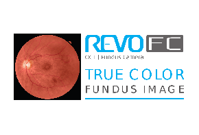 SD-OCT REVO FC
