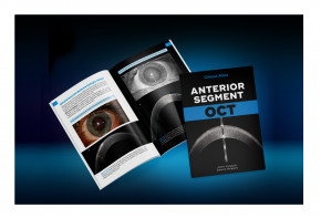 Clinical Atlas Anterior Segment OCT