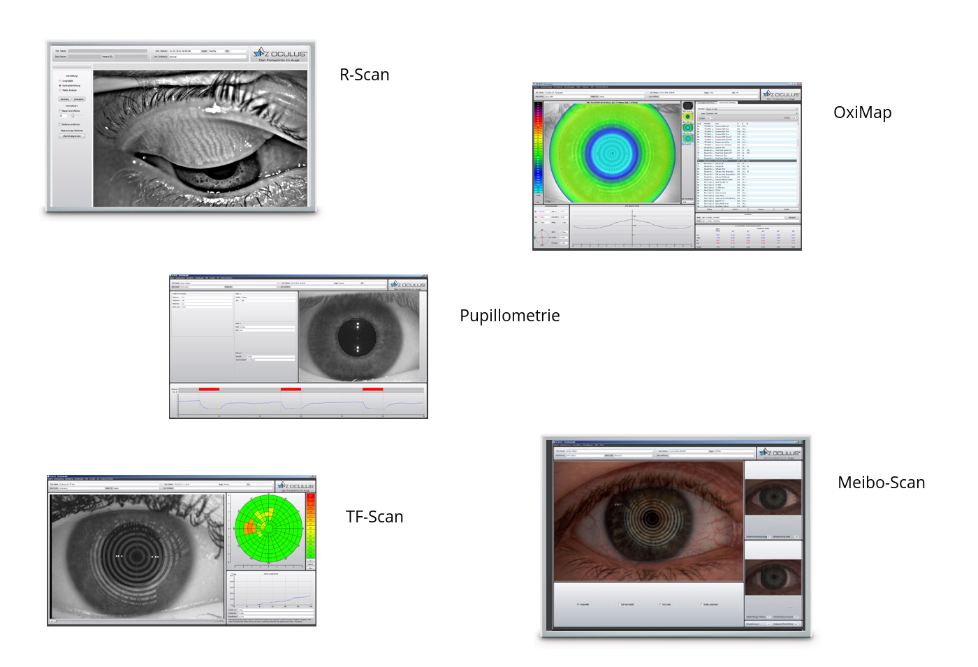 Oculus Keratograph 5M inkl. Imaging | 32400010